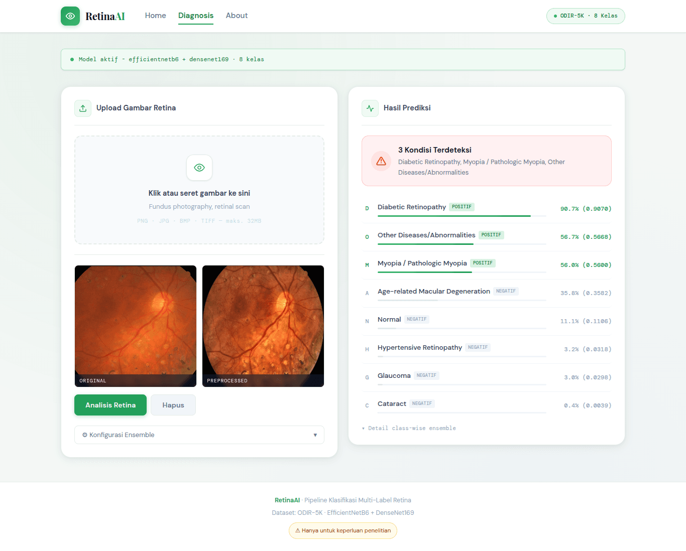 Retinal Diseases Diagnosis screenshot 1